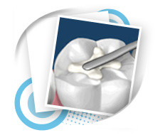 Dental Services Ellijay Dental Services Ellijay